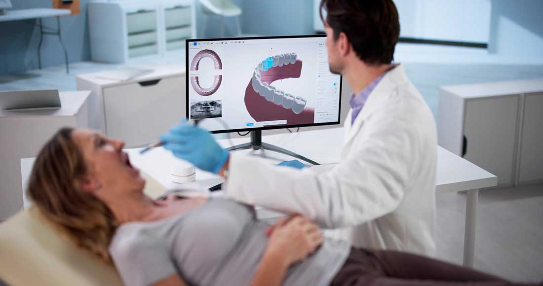 Dental implant 3D scanning