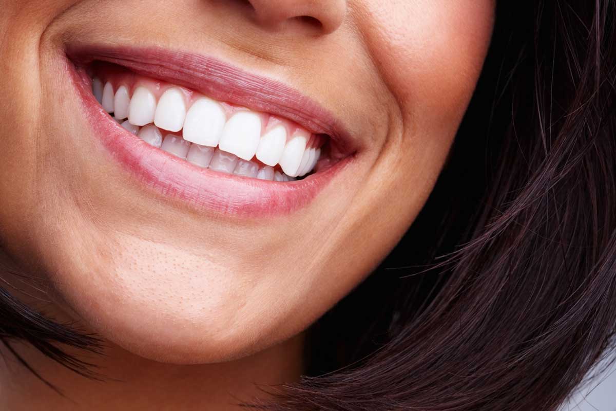 Dental Smile