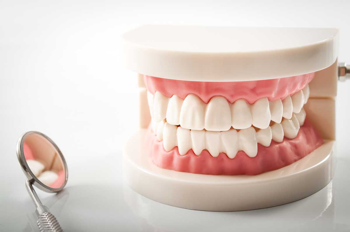 Denture Model