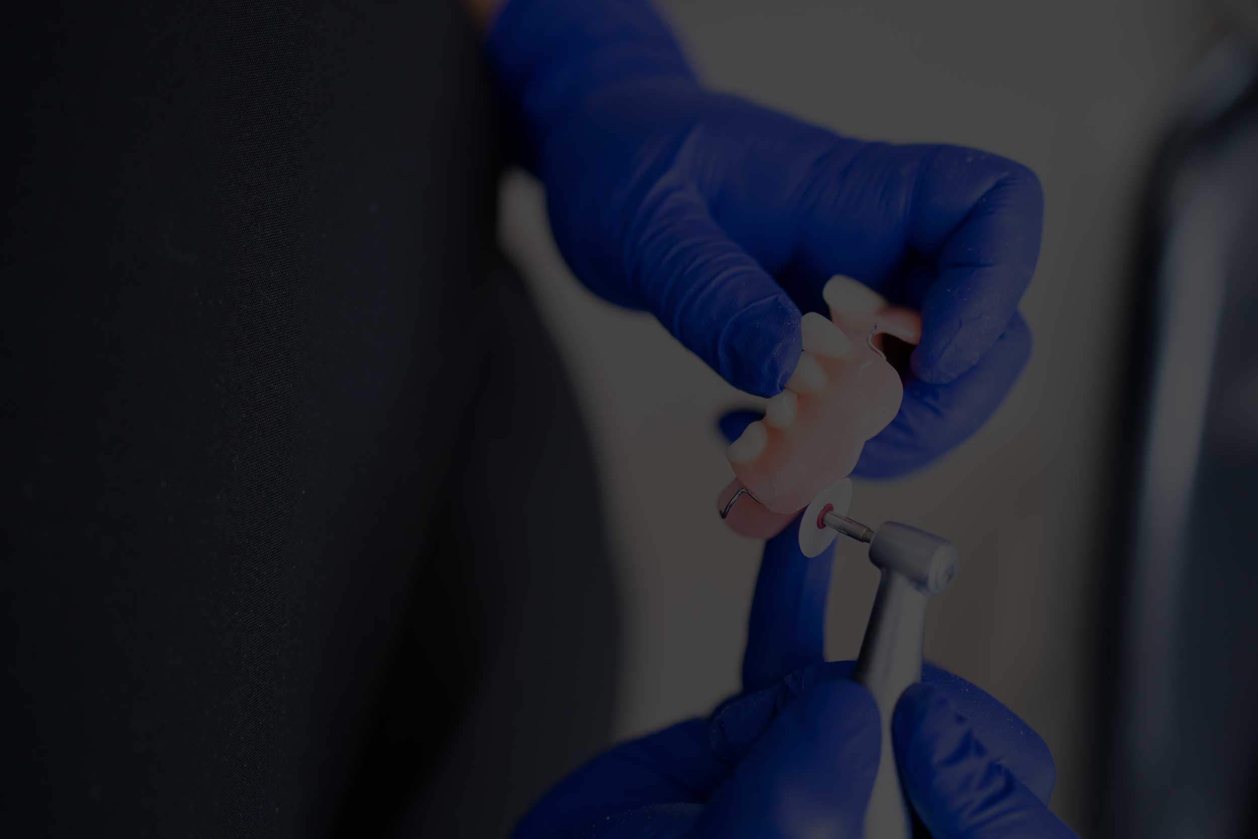 implant-supported dentures