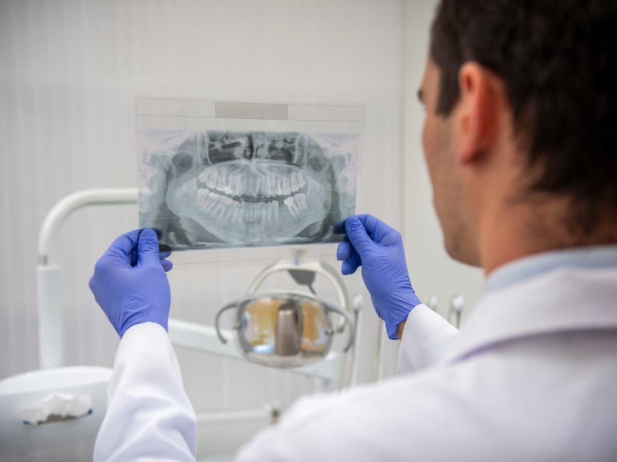 Reviewing xray