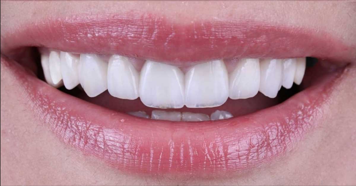 smile