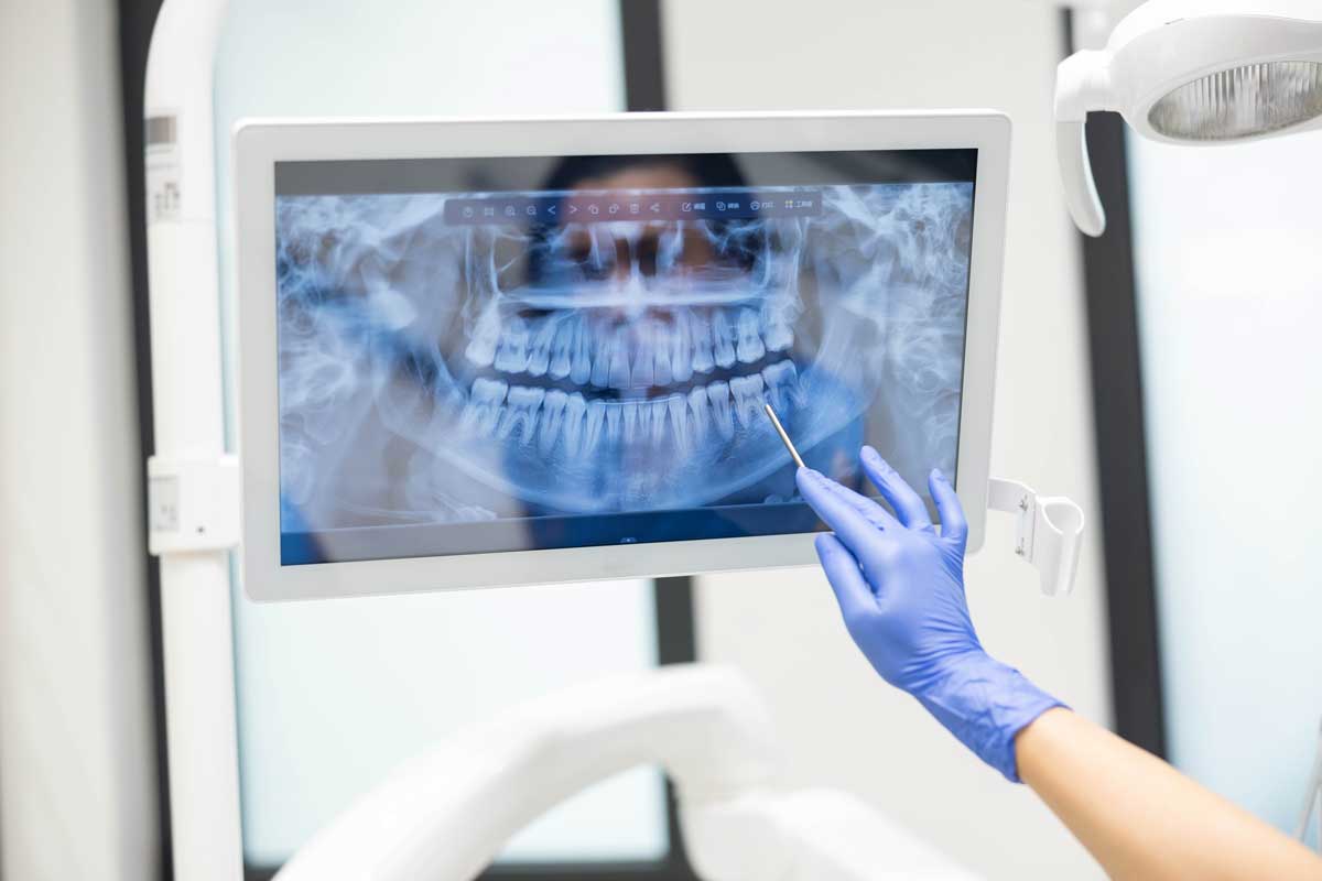 dental xray